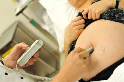 fetal dopplers