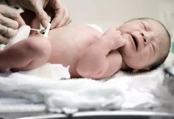 How to Clean Babies’ Belly Button after Umbilical Cord Falls Off