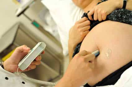 fetal dopplers